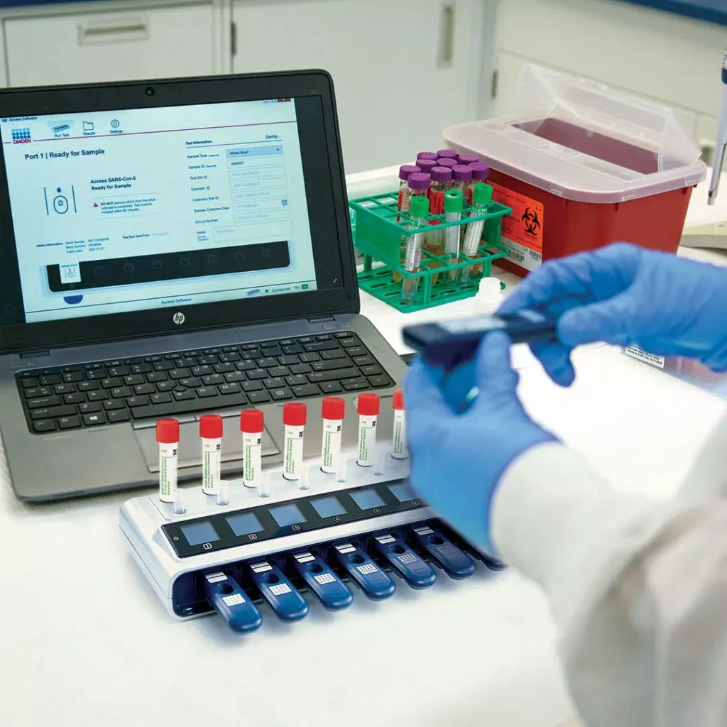 QuantiFERON-TB Gold Plus