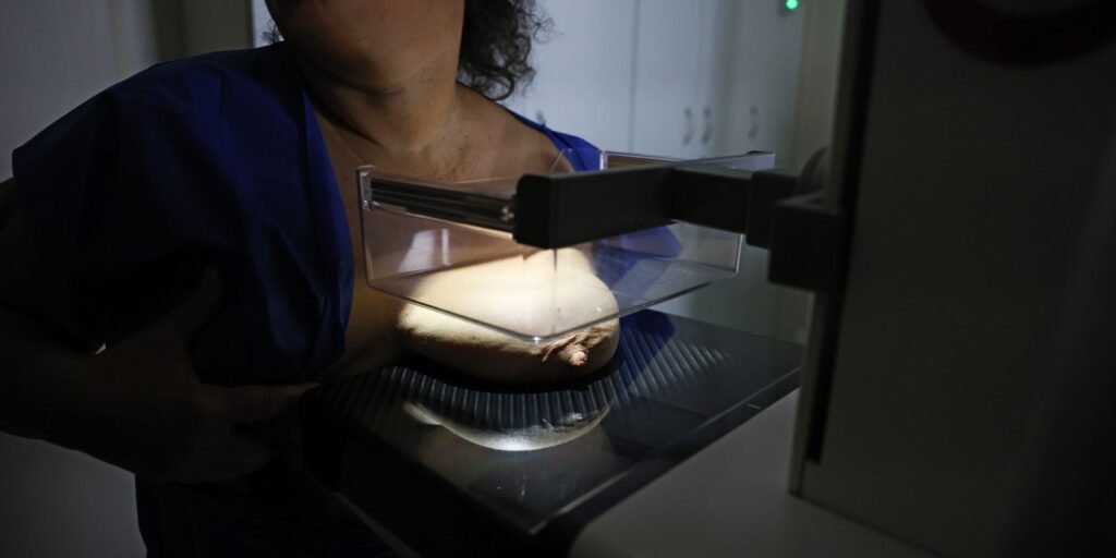 vigitel:-92%-das-brasileiras-entre-50-e-69-anos-fizeram-mamografia