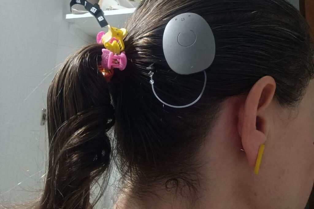 parana-assume-lideranca-nacional-em-implantes-de-correcao-auditiva-pelo-sus