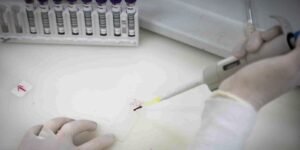 secretaria-de-saude-de-sp-investiga-novo-caso-suspeito-de-ebola