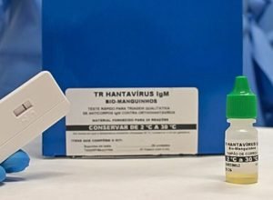 novo-teste-faz-diagnostico-de-hantavirose-em-20-minutos