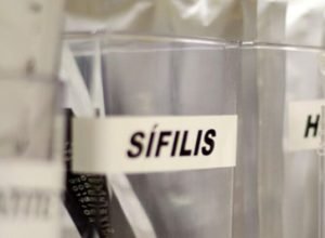 centro-de-sp-tem-testagem-gratis-de-hiv,-hepatite,-siflis-e-gonorreia