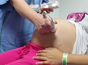 ultrassom-morfologico-passa-a-ser-ofertado-a-100%-das-gestantes-atendidas-no-parana