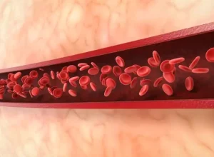 A trombose é a formação de coágulos dentro da circulação das artérias ou veias. O Dia Nacional de Combate e Prevenção à doença é em 16 de setembro Freepik