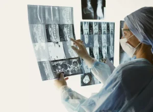 Diagnóstico de câncer em pessoas adultas abaixo de 50 anos aumentou quase 80% entre 1990 e 2019