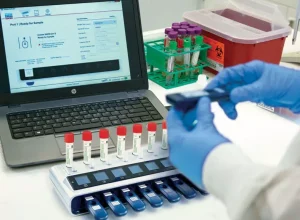 QuantiFERON-TB Gold Plus