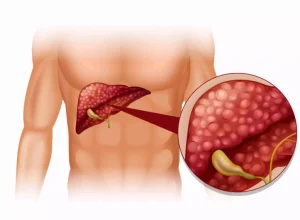 ulho Amarelo reforça o combate às hepatites virais